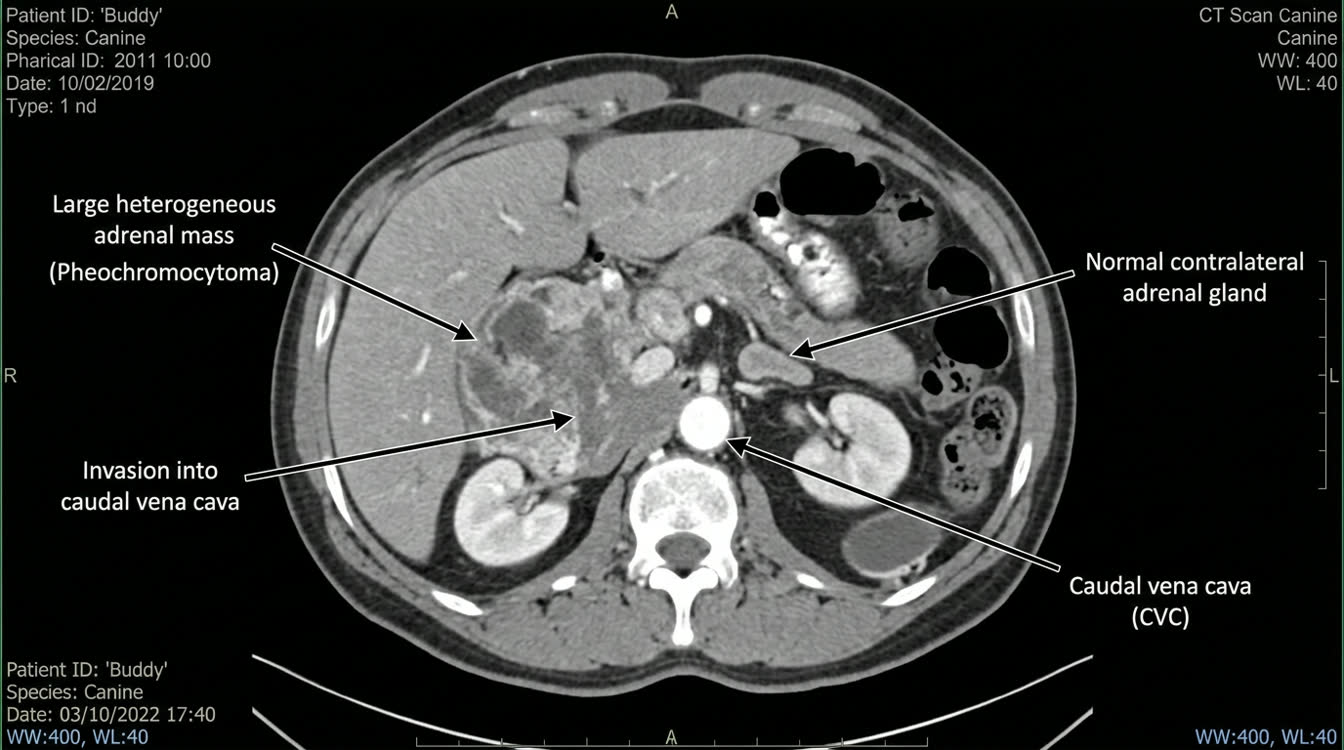 CT scan cross-section of dog abdomen showing large heterogeneous pheochromocytoma with vascular invasion