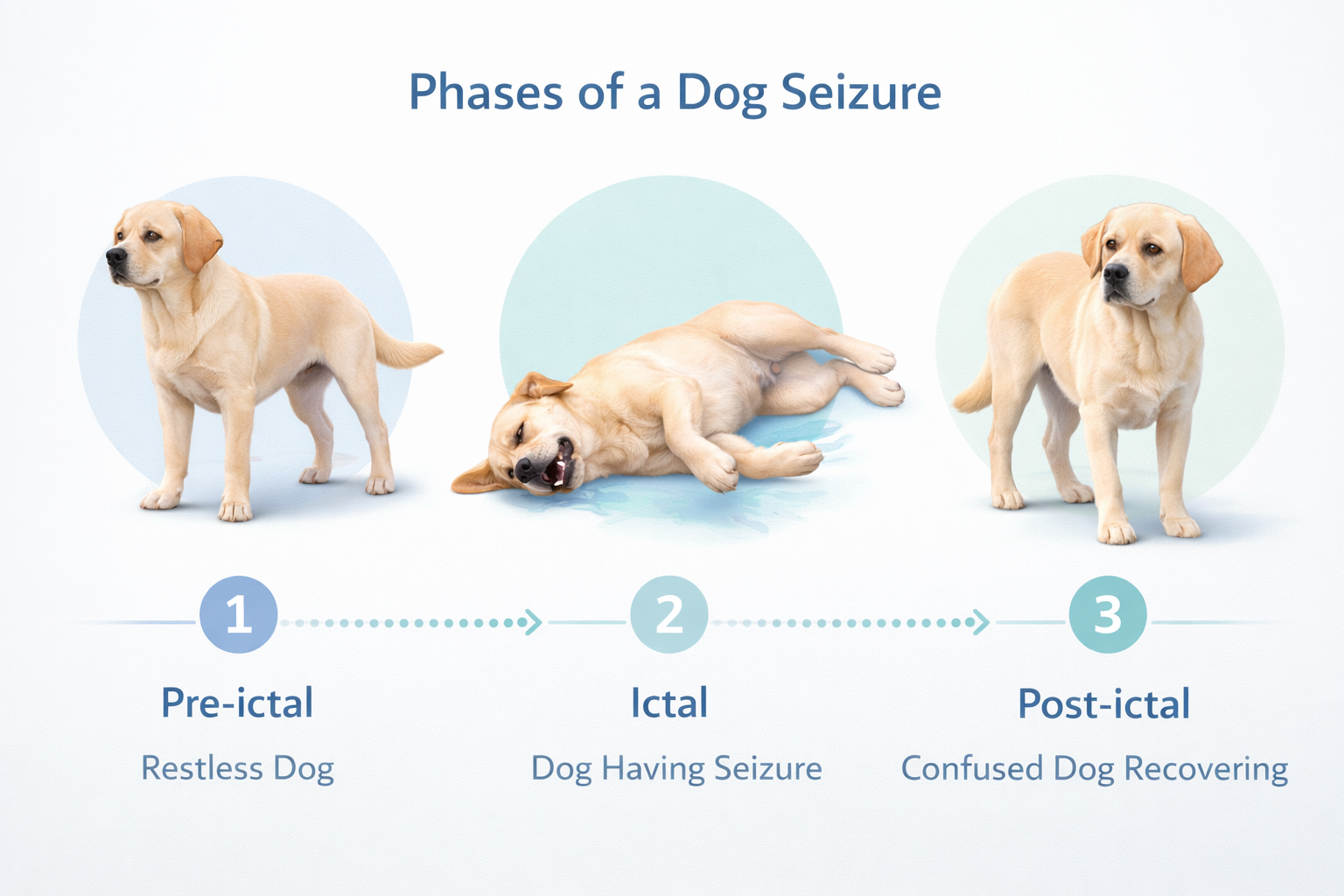 Infographic showing the three phases of a seizure: pre-ictal, ictal, and post-ictal